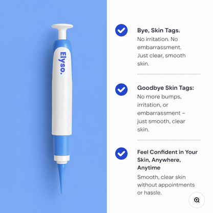 Say Goodbye to Skin Tags — From Home